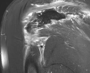 Figure 4 for case Stab wound